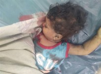 استشهاد طفل وجندي بهجومين حوثيين في تعز 