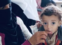 48 مليون دولار دعم أمريكي لمواجهة سوء التغذية لدى أطفال اليمن