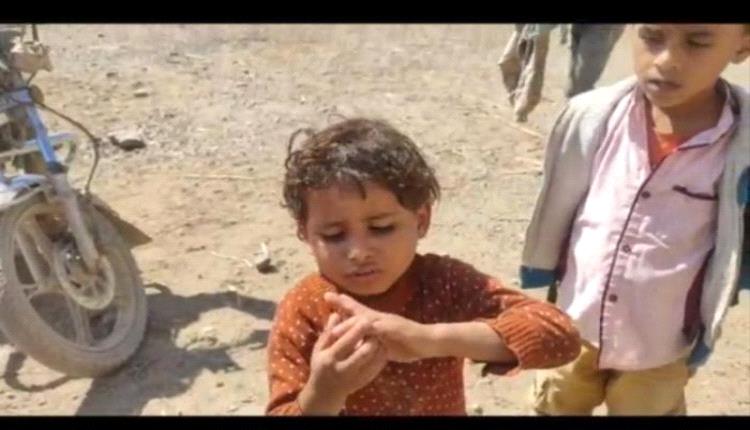 نجاة أطفال من اعتداء حوثي مسير في الضالع
