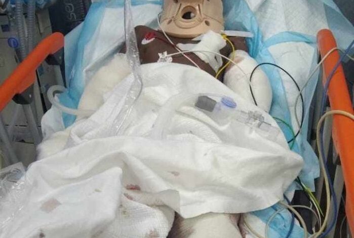 تشييع شعبي لجثمان طفل توفي بانفجار لغم حوثي في حجة