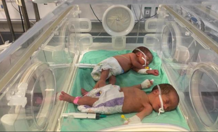 مستشفى كمال عدوان بغزة: استشهاد 15 طفلا بسبب الجفاف