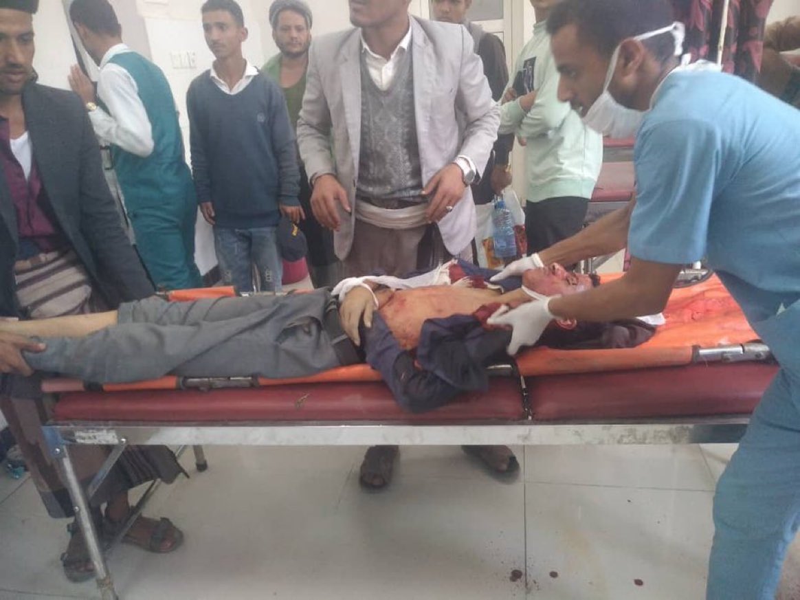 استشهاد شاب وإصابة آخر برصاص قناصة ميليشيا الحوثي في تعز