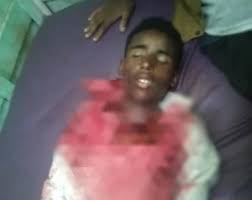 مقتل طفل وإصابة مدني آخر برصاص ميليشيا الحوثي في حجة