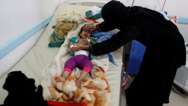 معظمها في مناطق سيطرة الحوثيين.. رصد 30 ألف إصابة بالكوليرا في اليمن منذ مطلع 2024